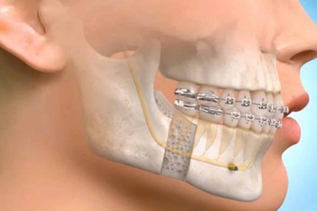 Maxillofacial Surgery Hospital in India Uttarkhand's Best Dental Hospital